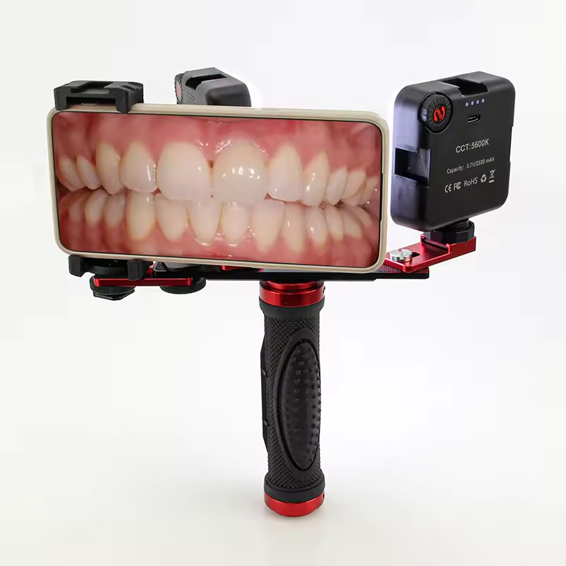 Photography With Mobile - Dental Mobile Photography LED Light Intraoral