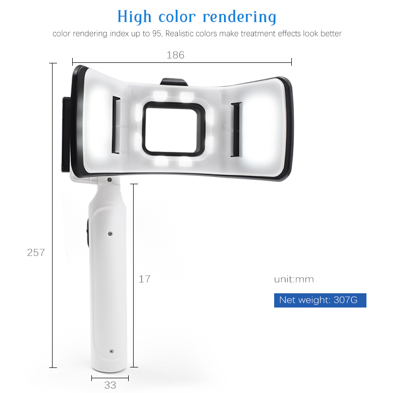 Professional Twin Flash Dental - Photography With Mobile recension och pris